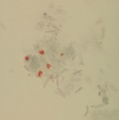 Microsporidia ML.jpg