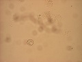 Cyclospora Bild 4 sporulerad oocysta.jpeg